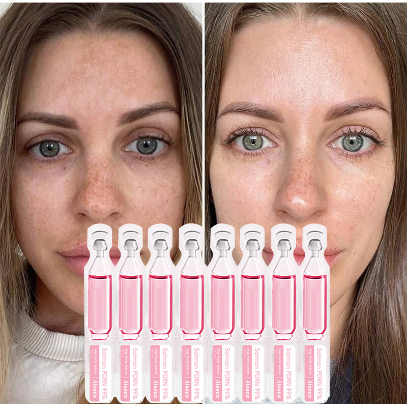 サーモン血清プロテインペプチドエッセンス 2ml X 10  - Collagen Peptide Powder のレビューと価格